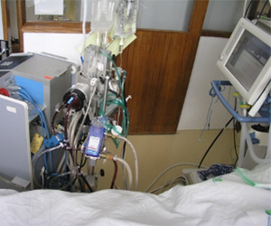 ECMO